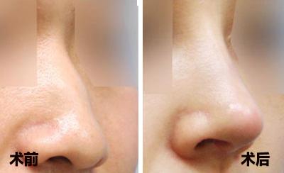 2023北京去眼紋醫(yī)生前10強(馮越蹇、夏成俊、張素娟優(yōu)質(zhì)專家匯總，快來看看吧)