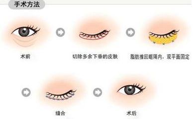 南寧治療痘印哪家醫(yī)院靠譜？—用戶首選南寧去痘印醫(yī)院排行榜