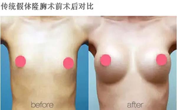 溫州雍禾醫(yī)院信譽如何？求推薦占家佳醫(yī)生植發(fā)效果如何？或溫州雍禾醫(yī)院口碑怎么樣？哪位醫(yī)生適合占家佳植發(fā)