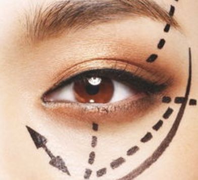 蘭州眼睛美容醫(yī)院哪家好？揭秘蘭州市最受歡迎的眼睛美容醫(yī)院排行榜！