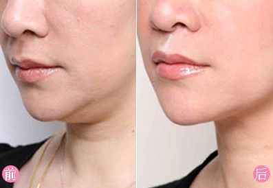 瀘州去疤痕哪家醫(yī)院好？疤痕修復(fù)盡在XXX?？漆t(yī)院！