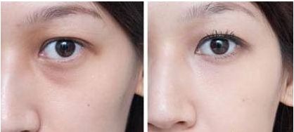 杭州哪家醫(yī)院做狐臭手術(shù)好且靠譜？