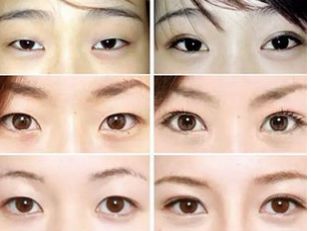 武漢去眼袋哪家好可信？揭秘眼袋整形專家推薦排行榜！