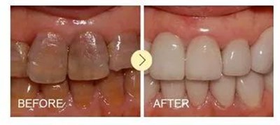 西安畫(huà)美楊萬(wàn)忠鼻部整形效果解析！楊萬(wàn)忠醫(yī)生簡(jiǎn)介及收費(fèi)準(zhǔn)則！