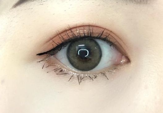 重慶去疤痕醫(yī)院有哪些專家？哪家去疤痕醫(yī)院好？