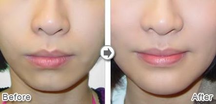 沈陽星美北順城醫(yī)療美容診所怎么樣？沈陽星美北順城醫(yī)療美容診所簡(jiǎn)介|醫(yī)生團(tuán)隊(duì)|口碑評(píng)價(jià)！