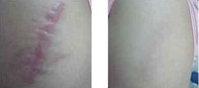 上海割眼袋哪家醫(yī)院靠譜？如何選擇上海割眼袋醫(yī)院？