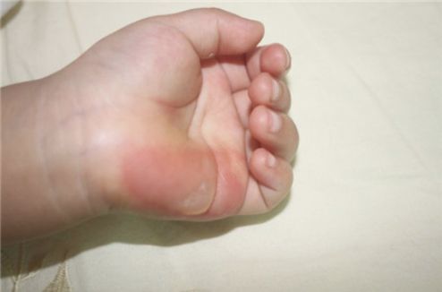 雙眼皮手術(shù)武漢哪家醫(yī)院好？熱門推薦及口碑解讀