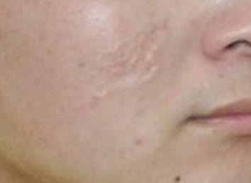 合肥整容醫(yī)生綜合排名TOP5，獨具經驗與在線咨詢服務