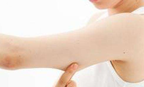 上海九院乳房重建，選擇哪位醫(yī)生比較好的？技術(shù)對(duì)比揭示了王濤、王煒、敏的優(yōu)勢(shì)