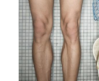 李楊西京醫(yī)院手術(shù)專(zhuān)家，助您完美小拉皮