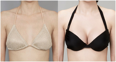 附去眼袋果圖，中心醫(yī)院邱曉東怎么樣治療效果如何