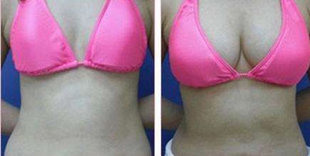 昆明哪家醫(yī)院的光子嫩膚祛斑效果好？