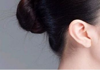 鄭州趙麗做雙眼皮修復(fù)效果如何？整形醫(yī)生背景和坐診情況請看！