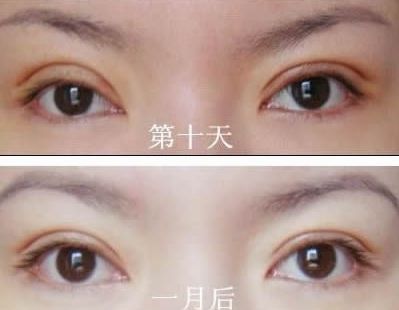 長春哪家醫(yī)院治痘痘好？了解長春市治療青春痘的?？漆t(yī)院及價格