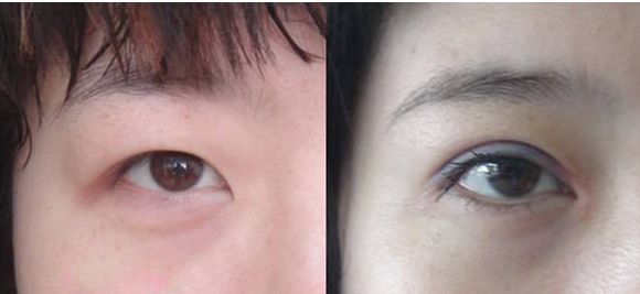 北京豐胸整形醫(yī)院哪家好？綜合評(píng)價(jià)和患者口碑推薦