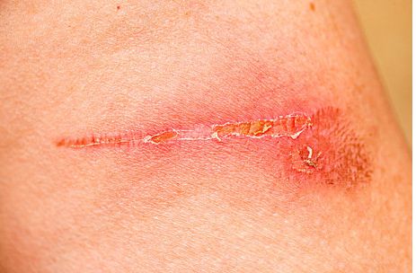 廣州整形醫(yī)院去哪家好？權(quán)威排行榜及患者口碑評(píng)價(jià)對(duì)比！