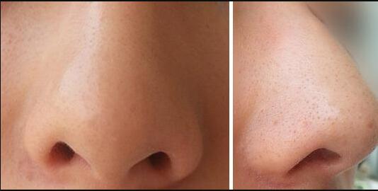 長沙鼻修復(fù)領(lǐng)域，哪位醫(yī)生口碑比較好的？五位知名專家匯總，推薦熱門醫(yī)師吳蒙！