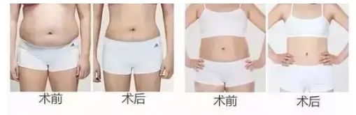 信陽去整形哪家醫(yī)院好？名副其實(shí)信陽市最佳整形醫(yī)院TOP推薦