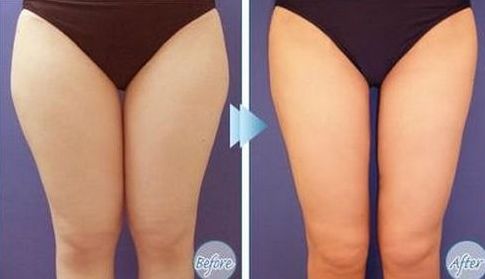 如何選擇最適合您的除腋臭治療醫(yī)院？全國哪家醫(yī)院好？