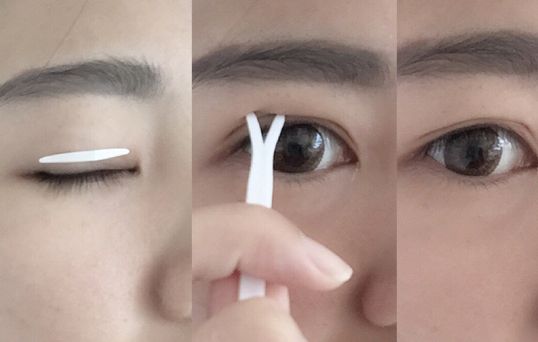 2023寧波除皺紋針評(píng)分前十名醫(yī)生(張利杰、胡繼來(lái)、任森洋口碑人氣都可)