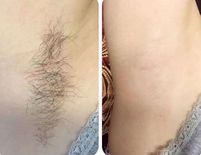 上海整形醫(yī)院哪家的好？最權(quán)威的排名榜單來幫你挑選！