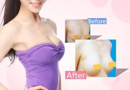 天津哪家醫(yī)院去疤痕好？專業(yè)醫(yī)生推薦的天津去疤痕頂級(jí)醫(yī)院有哪些？