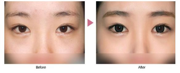 珠海整形醫(yī)院去哪家好？挑選術(shù)前評(píng)價(jià)好的整形醫(yī)院，放心修復(fù)您的美麗