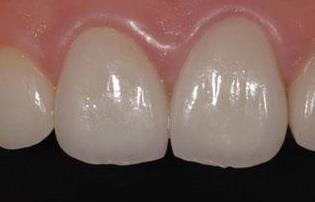 2023金華愛貝芙去除魚尾紋正規(guī)專家排行前十位(呂香花、李志金、鄧亮價格標(biāo)準(zhǔn)更新)