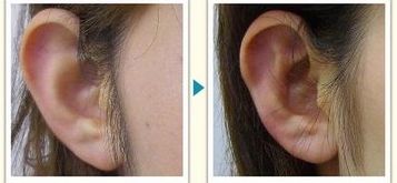 成都燒傷整形醫(yī)院哪家好？燒傷康復(fù)中心排名TOP5，專家支招！