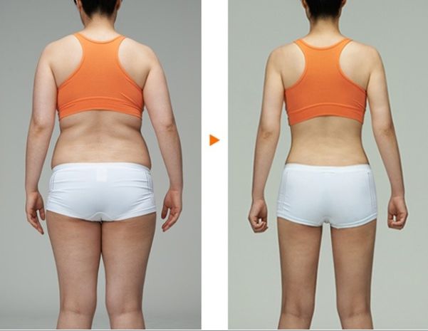 南京吸脂瘦臉哪家醫(yī)院好？全面解析南京吸脂手術(shù)的醫(yī)院排名及選擇攻略