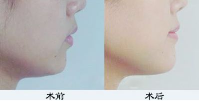 鄭州鼻綜合哪家醫(yī)院好？TOP醫(yī)療機(jī)構(gòu)大揭秘