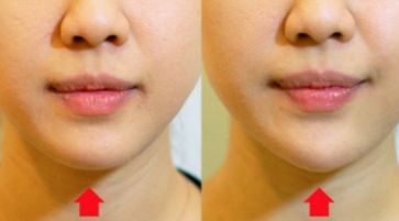 南京整容手術(shù)最靠譜的醫(yī)院排行榜，告訴你南京做整容手術(shù)醫(yī)院哪家好