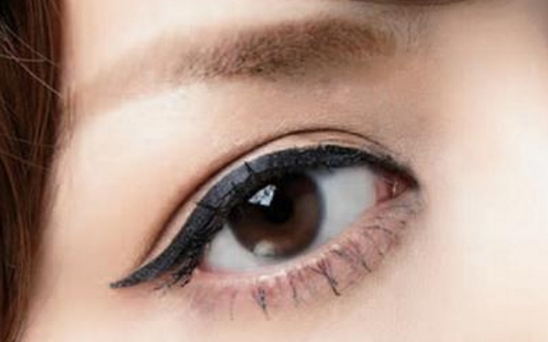 貴陽(yáng)雙眼皮整形醫(yī)生推薦：劉德東、徐威、陳誠(chéng)等技術(shù)可靠！