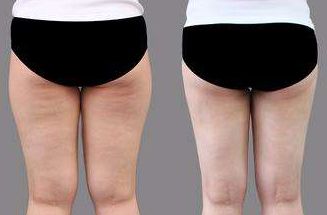 菏澤市整形醫(yī)院哪家好？排名榜單發(fā)布