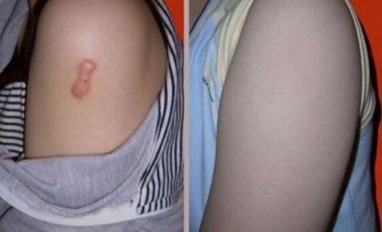 上海雙眼皮切開手術(shù)，哪家醫(yī)院技術(shù)好且安全？