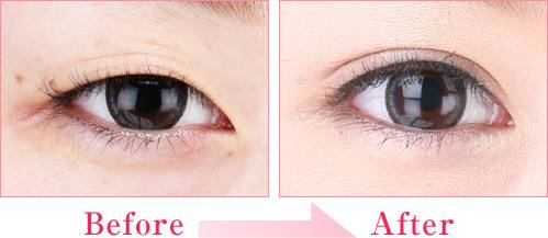 2023重慶鼻尖抬高專家top10強(qiáng)排名榜(張春明、黨寧、楊發(fā)菊名氣實(shí)力在線盤點(diǎn))