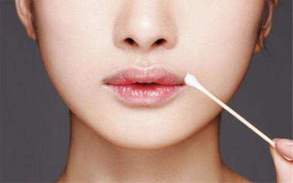 2023廣州除皺針去木偶紋正規(guī)醫(yī)生評分TOP10(楊權明、柳霞、丁莉美知名度很高)