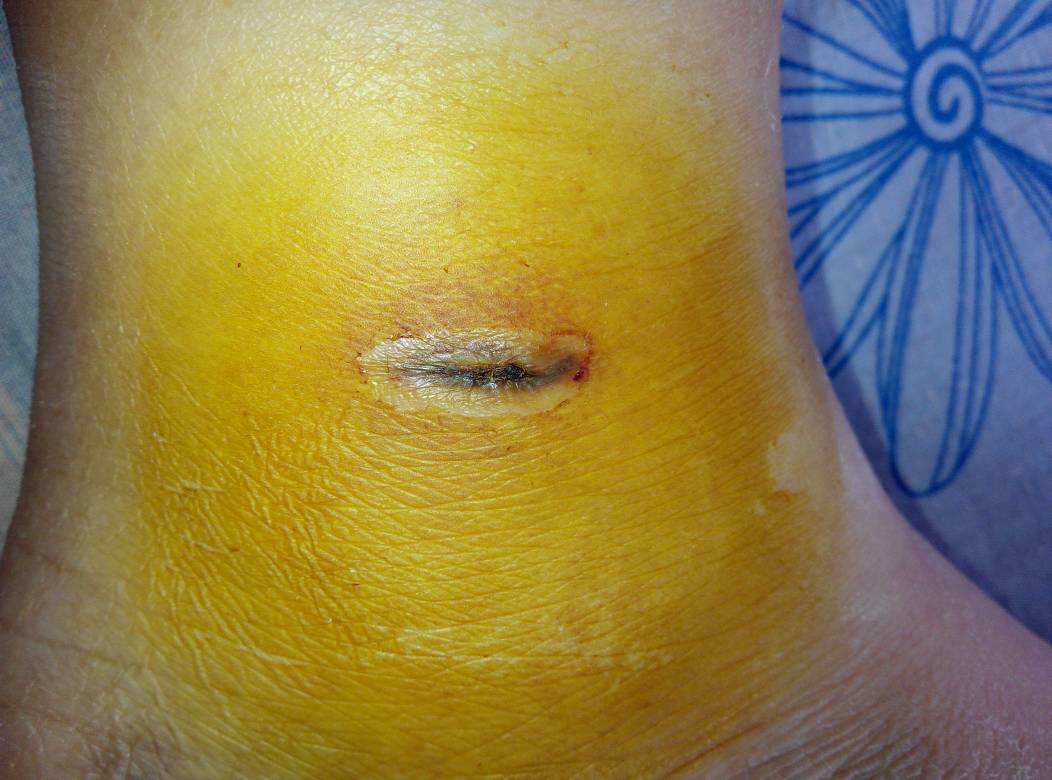 2023青海胸部脂肪填充排行前十名的醫(yī)生(周龍、張光武、張光武本地網(wǎng)友熱捧)