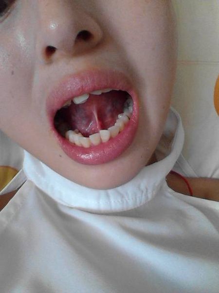 2023寧波botox除皺針權(quán)威專家排行前10強(qiáng)(茅來(lái)發(fā)、龔全康、田柏怡技術(shù)特色分享！)