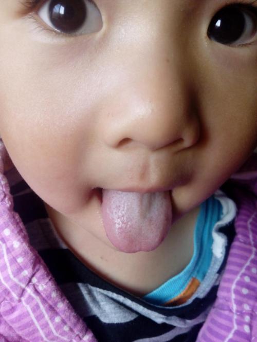 2023湛江玻尿酸聯(lián)合注射除皺抗衰正規(guī)專家評(píng)價(jià)前10位(鐘貴紅、陳審、李興均評(píng)價(jià)都是好的)