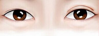 上海哪家醫(yī)院擅長激光治療？