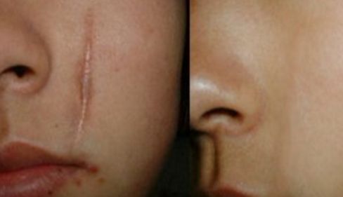 烏魯木齊眼袋手術(shù)專家推薦，哪家醫(yī)院好？