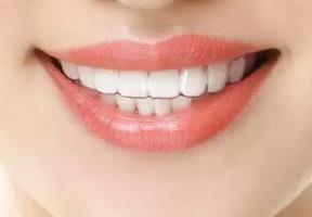 2023昆明自體填充口周紋口碑前十名醫(yī)生(黃鎔碩、張峰、牛勇敢在業(yè)內(nèi)領先同行)