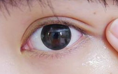 上海激光美白醫(yī)院排行榜及綜合評價