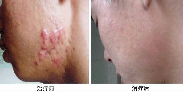 南京哪家醫(yī)院做兔唇手術(shù)效果好又安全？