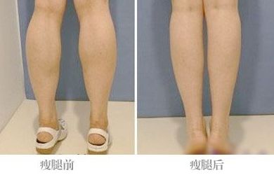 全國(guó)激光點(diǎn)痣哪家醫(yī)院好？帶你全面了解最佳選擇！