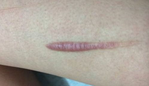 湘潭市美容哪家醫(yī)院好？探尋專家推薦，找到適合你的醫(yī)美機構(gòu)！