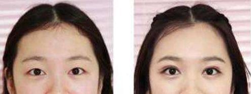 長沙整形科醫(yī)院排名及綜合評價：長沙哪家整形醫(yī)院口碑好？