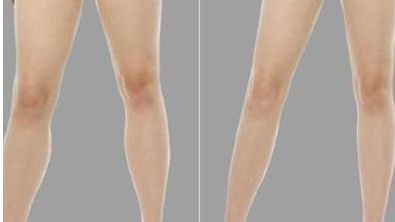 南京埋線醫(yī)院哪家好？權(quán)威專家推薦五家頂級(jí)醫(yī)院！